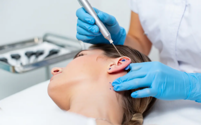 Auriculothérapie ménopause Rennes : solution naturelle efficace